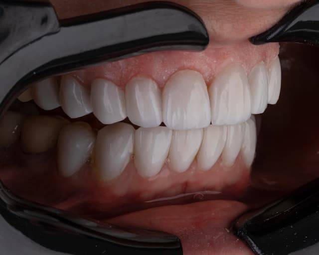 Sentido Noticias Magazin Curiosidades, Fotos y Vídeos 7 implantologia en Sevilla y salud dental
